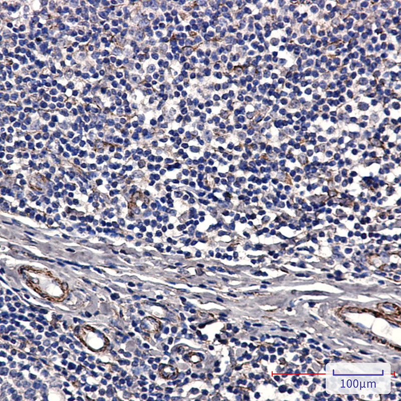 IRAK4 Rabbit mAb